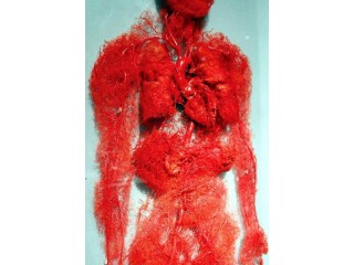 Веномакс показан при тромбозе артерий и вен, системном атеросклерозе.